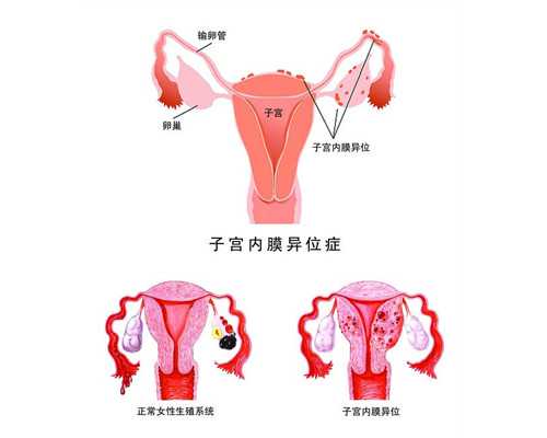 重庆助孕指南:试管婴儿费用、流程及成功率解析