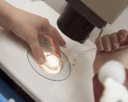 男性弱精症是否适合进行试管助孕？