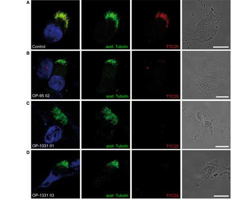 重庆试管助孕：全程解析与成功经验分享
