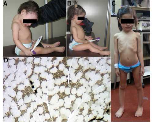 代生儿子的成功率，医保能否报销三代试管的费用？