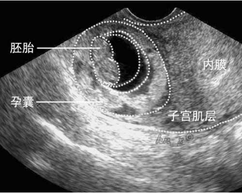 重庆单身男士供卵代怀 重庆试管助孕机构排名重庆北部妇产医院 ‘三次彩超女