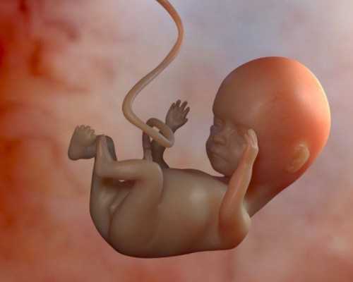 海外试管婴儿与唐氏综合征：概率与规避