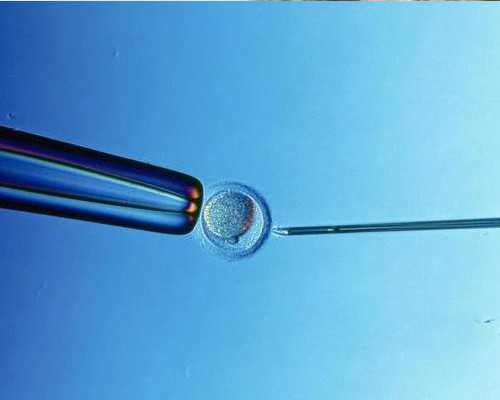 重庆找代怀公司,2026 北京做三代试管婴儿最好的医院排名附三家试管成功率医生