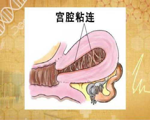 重庆找靠谱代孕,重庆哪里能做第三代试管婴儿？_怀孕初期症状经验分享_残角子