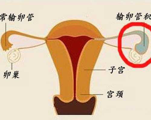 重庆冻卵供卵试管费用解析与助孕机构推荐