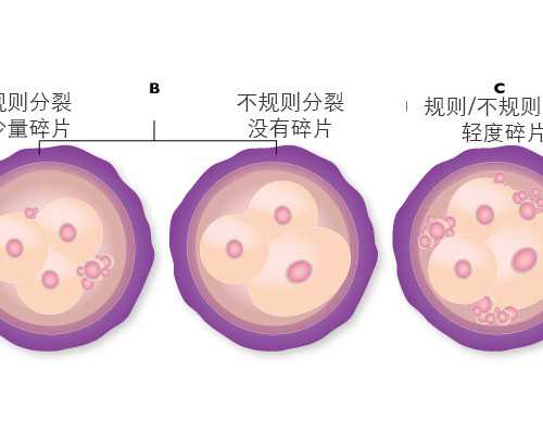 双胞胎重庆代生 2026重庆精子库医院大全，附重庆供精费用与成功率一览 ‘看